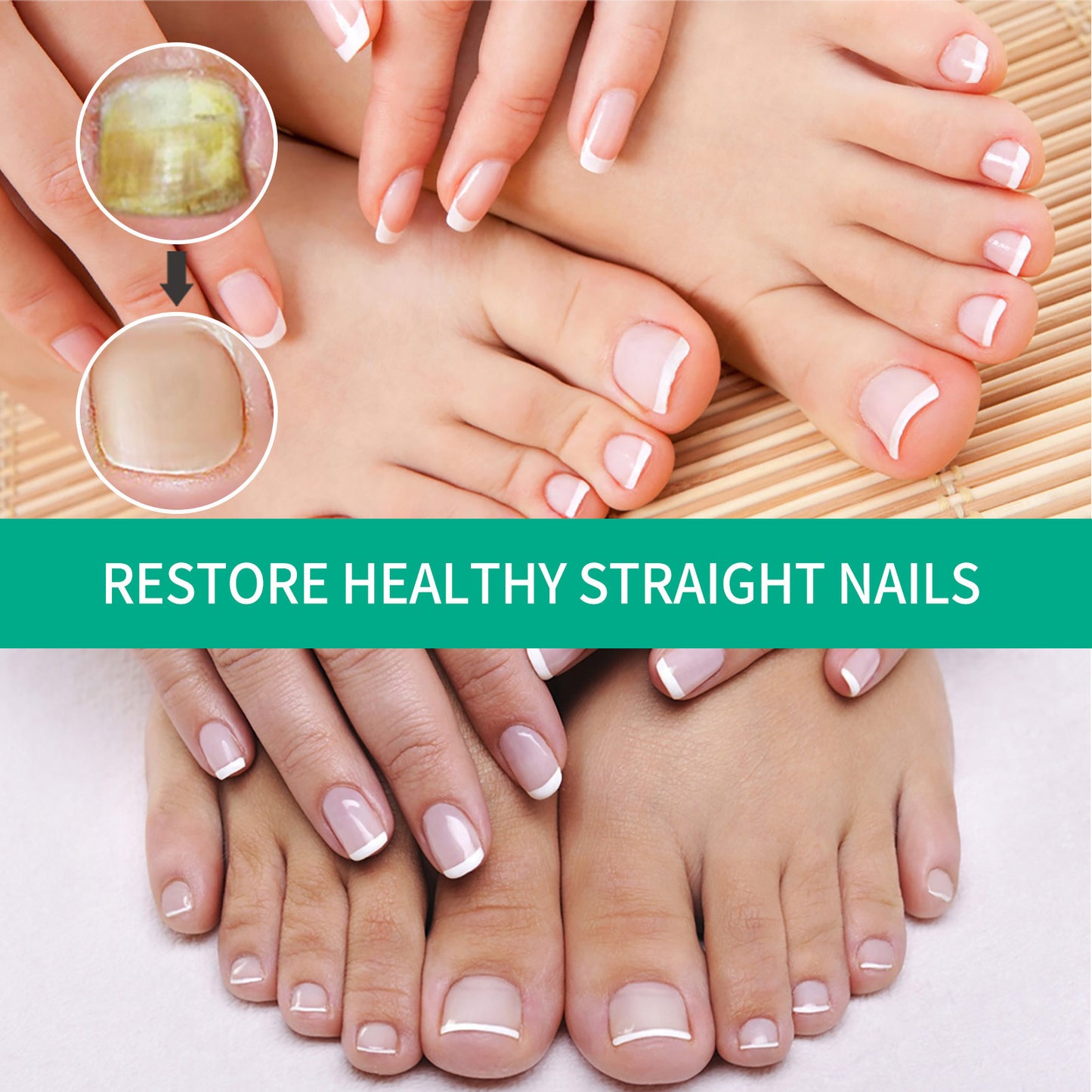 Repair Raw Nail Rotten Toenail Bad Gentle Get Rid Of Gray Dress Me Up